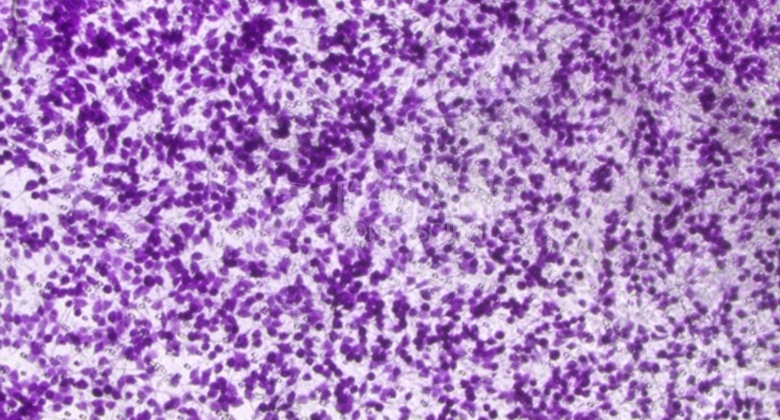 多重免疫荧光技术常见问题与解决方案